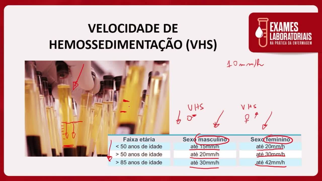 Exames Laboratoriais na Prática Enfermagem - Gustavo Dias